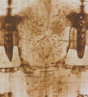 Les dégâts de la flagellation Les dégâts de la flagellation