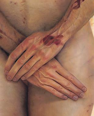 Blessures des clous de la crucifixion Blessures des clous de la crucifixion